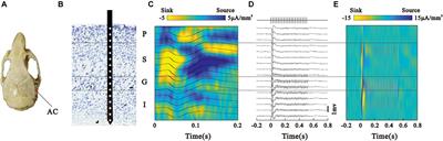 Laminar Profile of Auditory Steady-State Response in the Auditory Cortex of Awake Mice